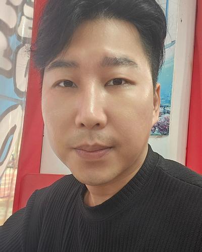 눈밑지방재배치 2주차, 짝짝이도 맞고 동안 됐다는 말 들어요 — 아바성형외과 환자 후기 사진
