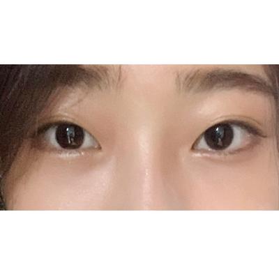 바비톡은 통신판매 당사자가 아니라는 안내 문구입니다 — 아바성형외과 환자 후기 사진