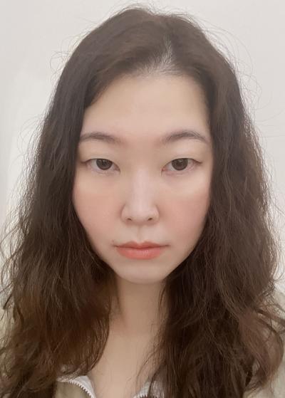 눈밑 수술 10주차, 눈밑 라인이 부드럽게 정돈됐어요 사진 2 — 아바성형외과 눈밑지방재배치 후기
