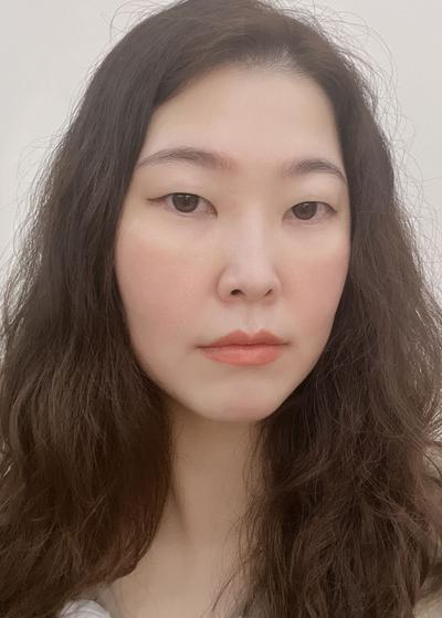 눈밑 수술 10주차, 눈밑 라인이 부드럽게 정돈됐어요 사진 3 — 아바성형외과 눈밑지방재배치 후기
