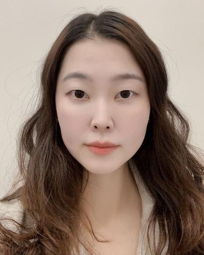 눈밑 수술 10주차, 눈밑 라인이 부드럽게 정돈됐어요 사진 4 — 아바성형외과 눈밑지방재배치 후기