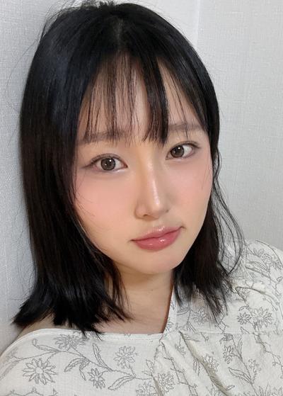 눈밑지방재배치 2주차, 수술한 줄 아무도 모를 만큼 자연스러워요 — 아바성형외과 환자 후기 사진