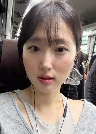 눈밑지방재배치 2주차, 수술한 줄 아무도 모를 만큼 자연스러워요 사진 3 — 아바성형외과 눈밑지방재배치 후기