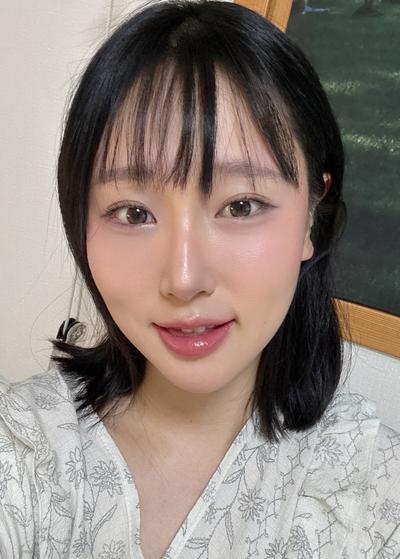 눈밑지방재배치 2주차, 수술한 줄 아무도 모를 만큼 자연스러워요 사진 4 — 아바성형외과 눈밑지방재배치 후기