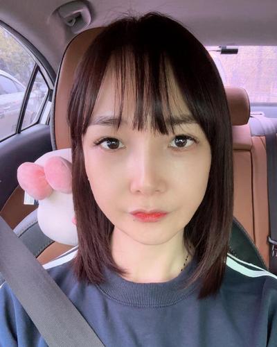 눈밑지방재배치 하안검 4주차, 꺼진 눈밑 잔주름 채웠어요 — 아바성형외과 환자 후기 사진