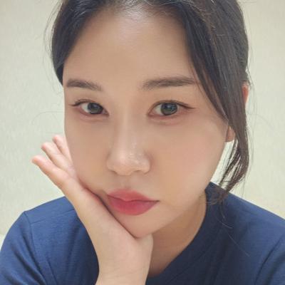 눈밑지방재배치 6주차, 눈밑이 평평해져서 화장이 편해요 — 아바성형외과 환자 후기 사진
