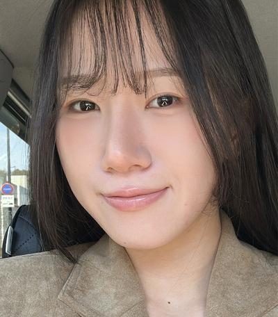 눈밑 시술 후기, 화장 안 해도 안색이 밝아 보여요 — 아바성형외과 환자 후기 사진