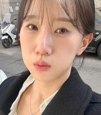 눈밑 시술 후기, 화장 안 해도 안색이 밝아 보여요 사진 4 — 아바성형외과 눈밑지방재배치 후기