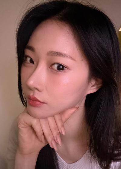 눈밑지방재배치 6주차, 제 수술 중 만족도 탑3에 들어요 — 아바성형외과 환자 후기 사진
