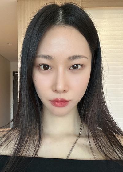 눈밑지방재배치 6주차, 제 수술 중 만족도 탑3에 들어요 사진 4 — 아바성형외과 눈밑지방재배치 후기