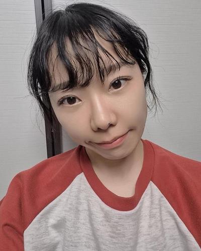 눈성형 환자 후기 — !! 브라운성형외과 김승수원... (167)