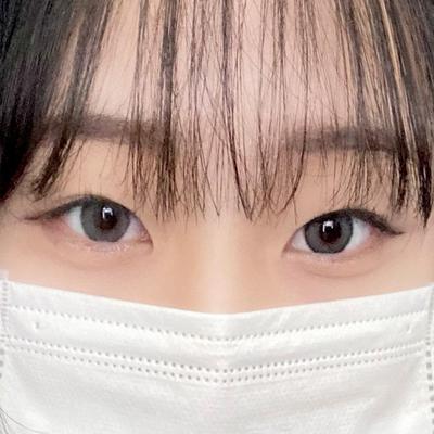 매몰＋윗트임 2개월차, 짝짝이 눈 탈출하고 부러움 받아요 사진 3 — 아바성형외과 쌍꺼풀·눈성형 후기