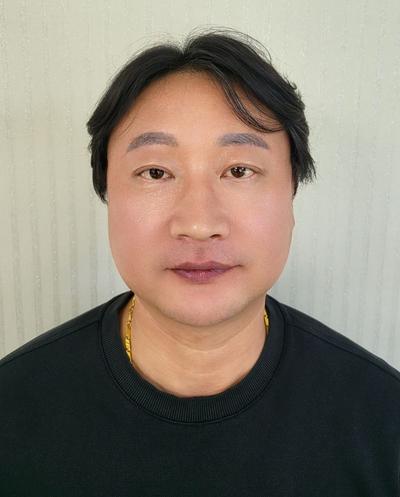 수술 15주차, 자연스러운데 어려보인다는 얘기 들어요 — 아바성형외과 환자 후기 사진