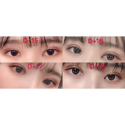 쌍꺼풀 눈매교정 윗트임 2주차, 답답한 눈이 개과천선했어요 사진 4 — 아바성형외과 쌍꺼풀·눈성형 후기