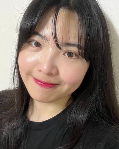 눈밑지방재배치 4주차, 처진 눈가 자연스러워져 대만족 — 아바성형외과 환자 후기 사진