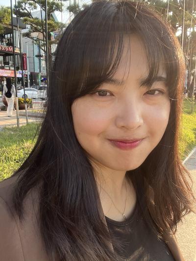 눈밑지방재배치 4주차, 처진 눈가 자연스러워져 대만족 사진 2 — 아바성형외과 눈밑지방재배치 후기
