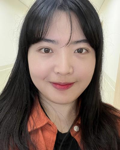 눈밑지방재배치 4주차, 처진 눈가 자연스러워져 대만족 사진 4 — 아바성형외과 눈밑지방재배치 후기