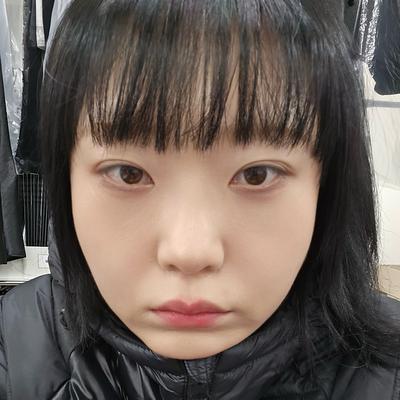 눈밑지방재배치 6주차, 짝짝이 사라지고 눈가가 환해졌어요 — 아바성형외과 환자 후기 사진
