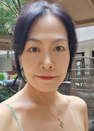 하안검 2개월차, 8주 지나니 완전 자연스럽고 젊어 보여요 — 아바성형외과 환자 후기 사진