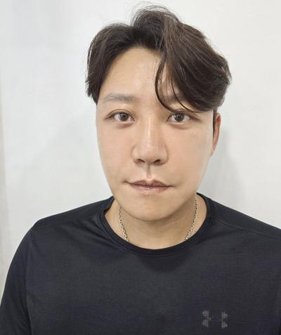 안면거상 5주차 후기, 경과 기록 남겨봅니다 — 아바성형외과 환자 후기 사진