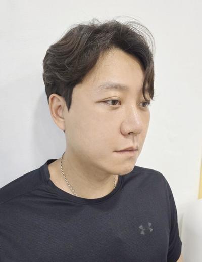 안면거상 5주차 후기, 경과 기록 남겨봅니다 사진 4 — 아바성형외과 안면거상 후기