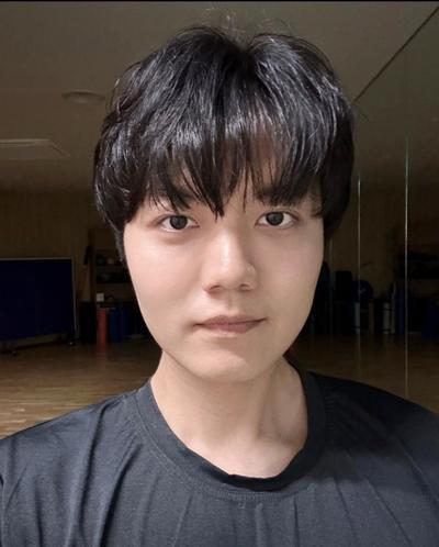 눈밑지방재배치 2개월차, 고민이던 다크서클 효과 그대로 유지돼요 — 아바성형외과 환자 후기 사진