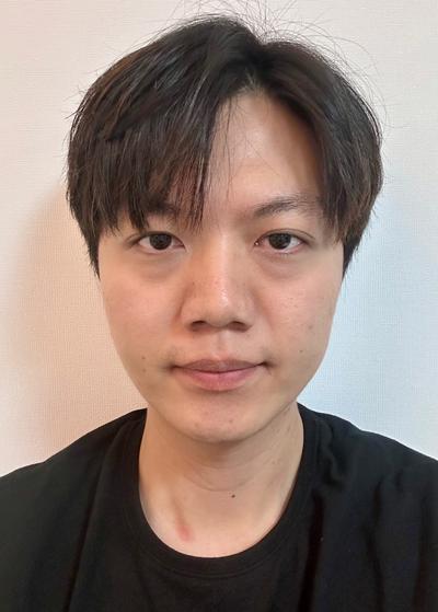 눈밑지방재배치 2개월차, 고민이던 다크서클 효과 그대로 유지돼요 사진 2 — 아바성형외과 눈밑지방재배치 후기
