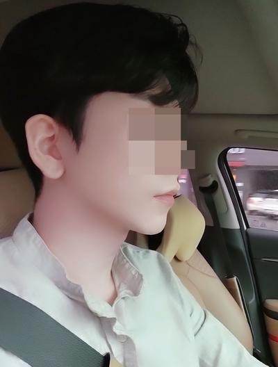 안면거상 환자 후기 — #브라운성형외과 #김태규 원... (216)