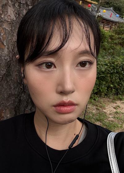 수술 1주차 붓기 빠지고 나니 인상이 확 깔끔해졌어요 사진 2 — 아바성형외과 기타 후기
