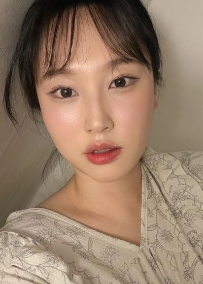 수술 1주차 붓기 빠지고 나니 인상이 확 깔끔해졌어요 사진 4 — 아바성형외과 기타 후기