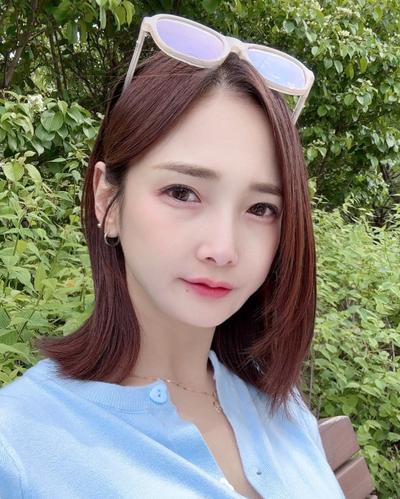 눈밑주름 꺼짐 고민 끝, 수술 10주차 효과 짱짱해요 사진 2 — 아바성형외과 눈밑지방재배치 후기