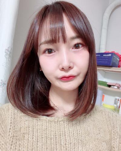 눈밑주름 꺼짐 고민 끝, 수술 10주차 효과 짱짱해요 사진 3 — 아바성형외과 눈밑지방재배치 후기