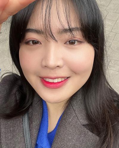 눈밑지방재배치 6주차, 잔붓기 빠지고 화장도 자유로워요 — 아바성형외과 환자 후기 사진