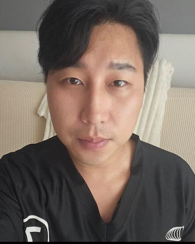 눈밑지방재배치 10주차, 왜 진작 안 했나 싶을 만큼 만족 사진 2 — 아바성형외과 눈밑지방재배치 후기