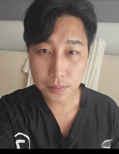 지방이식 6주차, 멍 붓기 2주 지나니 확 좋아졌어요 사진 2 — 아바성형외과 지방이식 후기