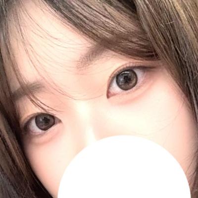 눈밑지방재배치 8주차, 심했던 다크서클 진짜 없어졌어요 사진 4 — 아바성형외과 눈밑지방재배치 후기