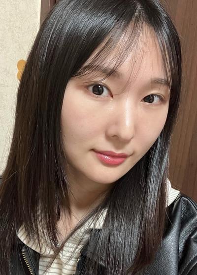 눈밑꺼짐 수술, 화장시간 줄고 피곤해 보이지 않아요 사진 4 — 아바성형외과 눈밑지방재배치 후기
