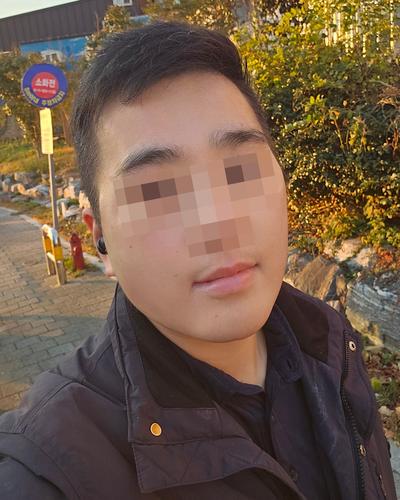 얼굴지방흡입·이중턱근육묶기 4주차, 턱선 진짜 날렵해졌어요 사진 4 — 아바성형외과 이중턱·윤곽 후기