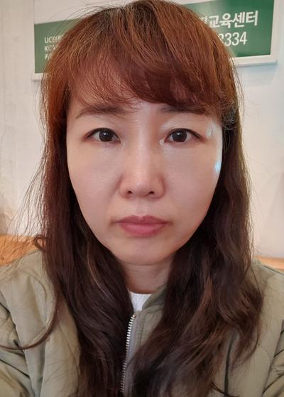 시술 후기 남깁니다, 상담부터 경과까지 기록 — 아바성형외과 환자 후기 사진