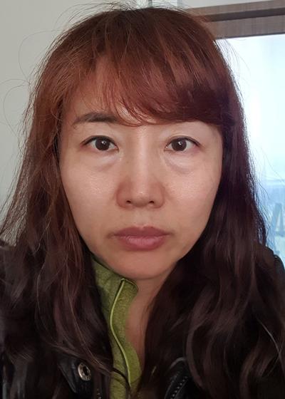 시술 후기 남깁니다, 상담부터 경과까지 기록 사진 2 — 아바성형외과 기타 후기