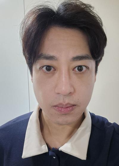 눈매교정＋눈밑지방재배치, 피곤한 인상 없어지고 또렷해졌어요 — 아바성형외과 환자 후기 사진