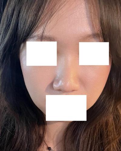 기타 환자 후기 — 브라운에서 김승수 원장님께 ... (28)