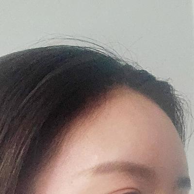이마지방이식 4주차, 티 안 나게 예뻐졌다는 말 들어요 사진 4 — 아바성형외과 이마거상 후기