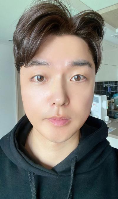 친구 소개로 받은 시술, 3일차 붓기 관리 중이에요 사진 4 — 아바성형외과 기타 후기
