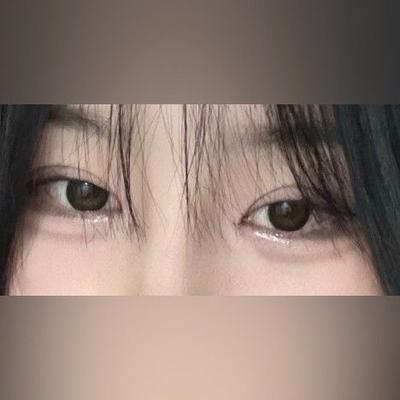 쌍꺼풀 4주차, 인아웃라인으로 어중간했던 눈 바뀌었어요 — 아바성형외과 환자 후기 사진