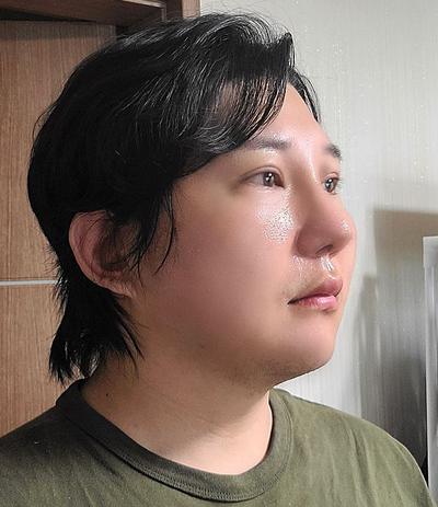 안검하수 절개 재수술 5주차, 눈 피곤함이 사라졌어요 사진 4 — 아바성형외과 쌍꺼풀·눈성형 후기