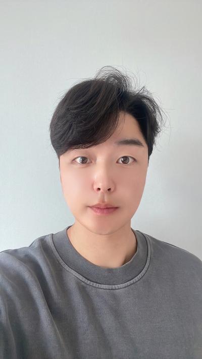 쌍꺼풀 수술 후기, 말 안 하면 모를 만큼 자연스러워요 — 아바성형외과 환자 후기 사진