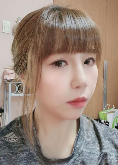 코재수술 후기, 발품 팔길 잘했어요 코끝 진짜 자연스러워요 — 아바성형외과 환자 후기 사진