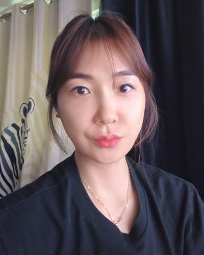 눈밑 꺼짐 고민하다 시술, 너무 잘돼서 마음에 쏙 들어요 — 아바성형외과 환자 후기 사진