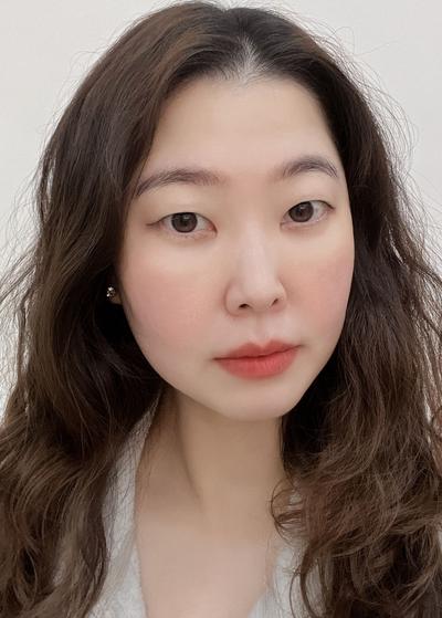 눈밑꺼짐 수술 6주차, 화장으로 못 가리던 그늘 없어졌어요 — 아바성형외과 환자 후기 사진